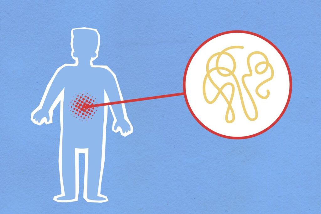 Microbiote intestinal : comment en prendre soin
